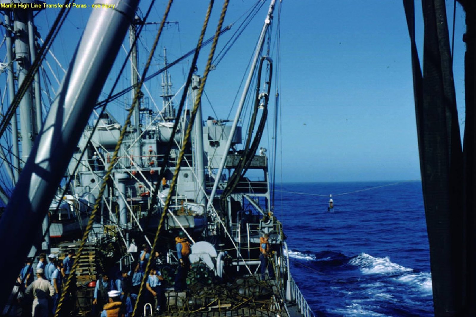 Manila High Line Transfer of Paras - eye injury | USS Ashtabula (AO-51)